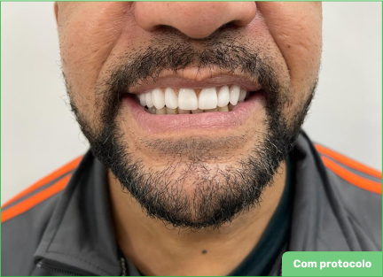 Protocolo - Odonto Company São Bernardo
